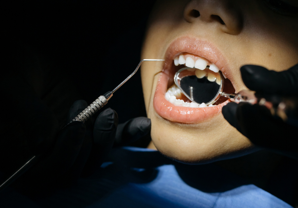 Oral cancer awareness Dr. Kathy Soleimani | Dental Aesthetics and Wellness Center | CA