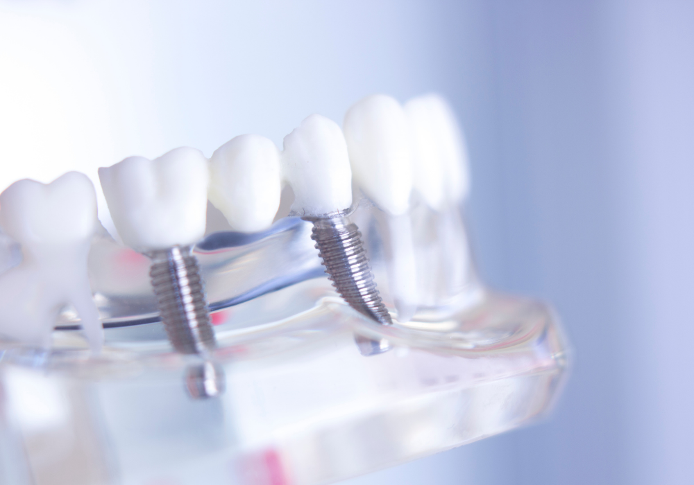 Dental Esthetics banner - | Dental Aesthetics and Wellness Center | CA