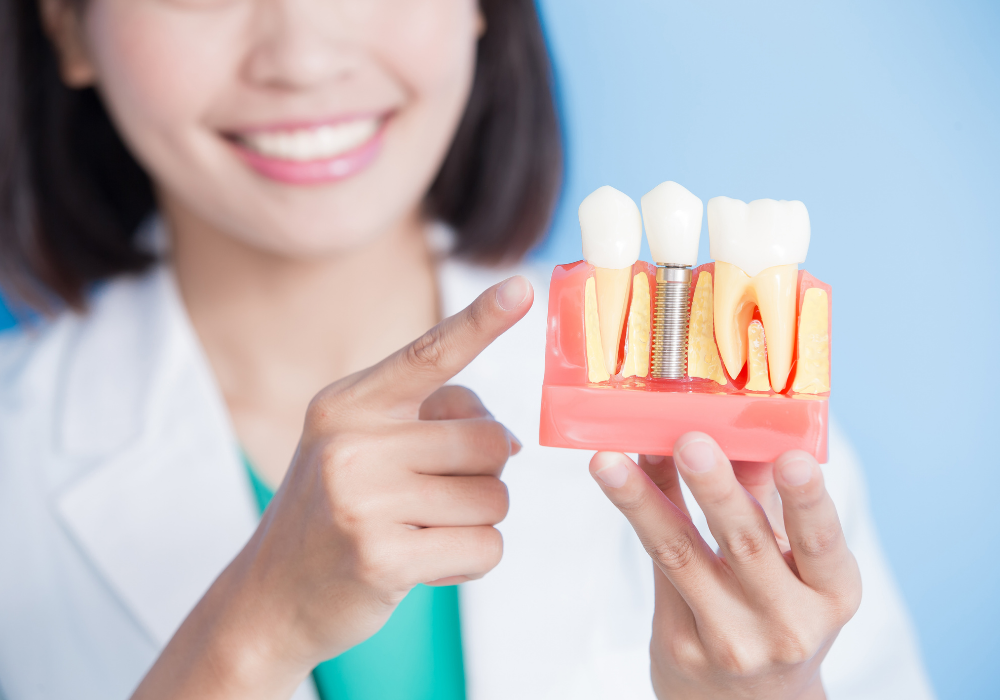 Dental implant Dr. Kathy Soleimani | Dental Aesthetics and Wellness Center | CA