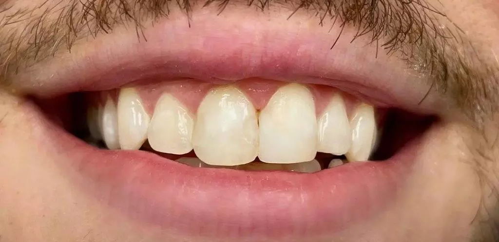 case2-a