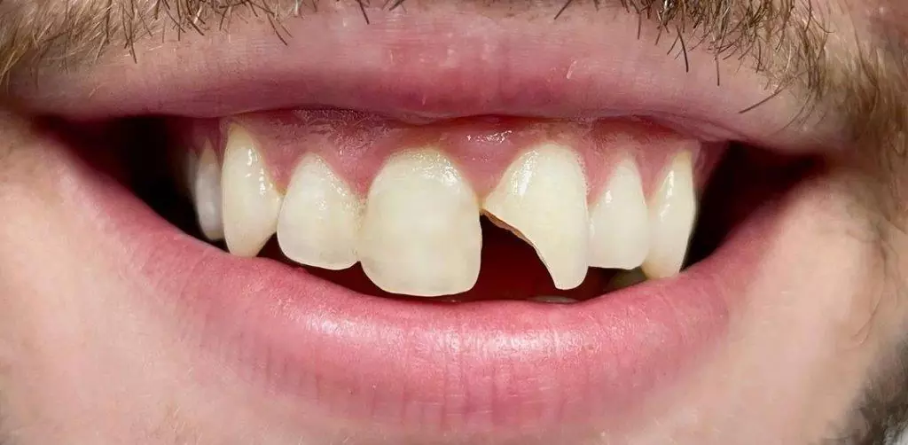 case2-b