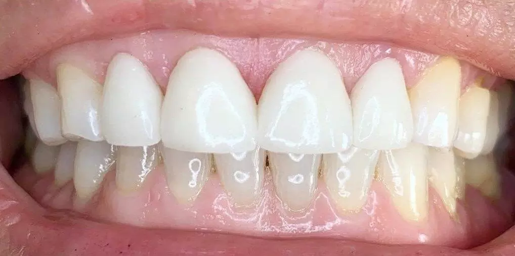 case4-a