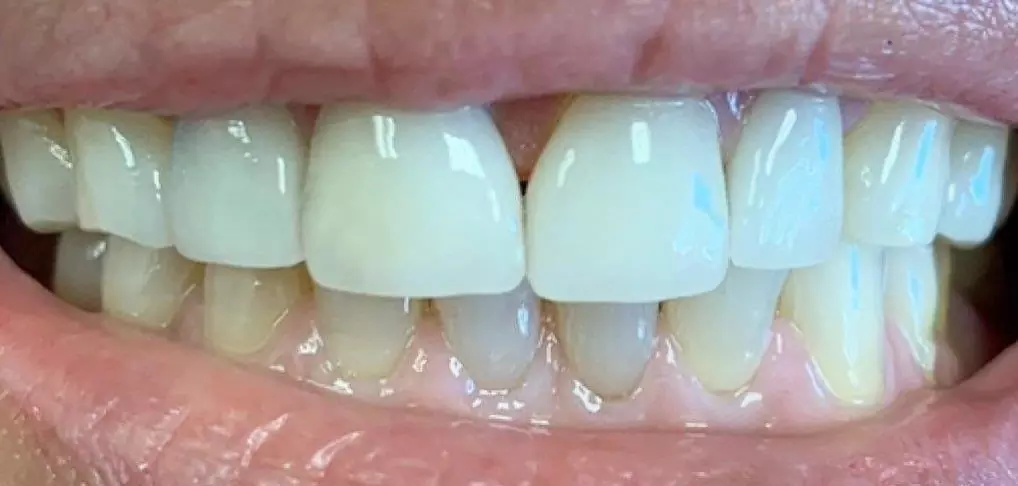 case4-b